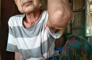 ကတိုင်တိ BGF- စခန်းမှ လက်နက်ကြီး ရမ်းသမ်းပစ်ခတ်မှုကြောင့် ကလေးတစ်ဦးနှင့် အမျိုးသမီးတစ်ဦး ထိခိုက်ဒဏ်ရာရ