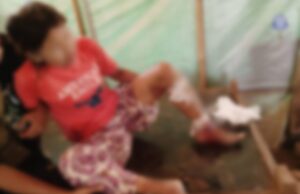 ခလယ်လွီထူခရိုင်တွင် အာဏာသိမ်းစစ်တပ် လက်နက်ကြီးနှင့် ဒရုန်းဖြင့် ပစ်ခတ်မှုကြောင့် အရပ်သား ၅ ဦး ဒဏ်ရာရ
