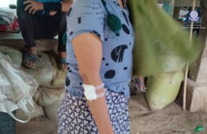 လယ်ဒိုမြို့နယ်တွင် စစ်အုပ်စု၏ လက်နက်ကြီးပစ်ခတ်မှုကြောင့် ဒေသခံ ၃ ဦး ဒဏ်ရာရပြီး နေအိမ် ၃ လုံး ပျက်စီး