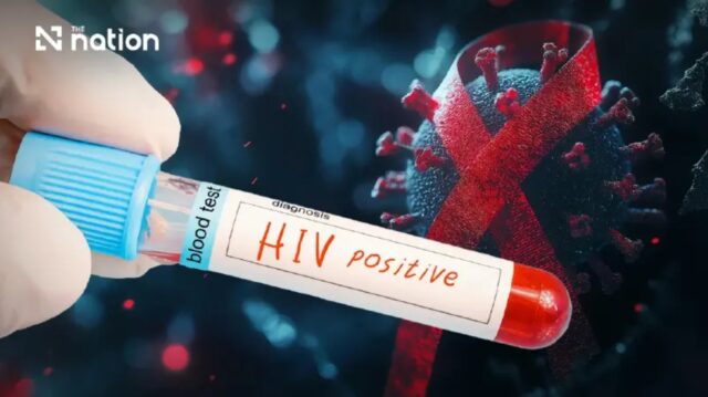 HIV